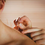 Acupuncture For Neck Pain In Morristown